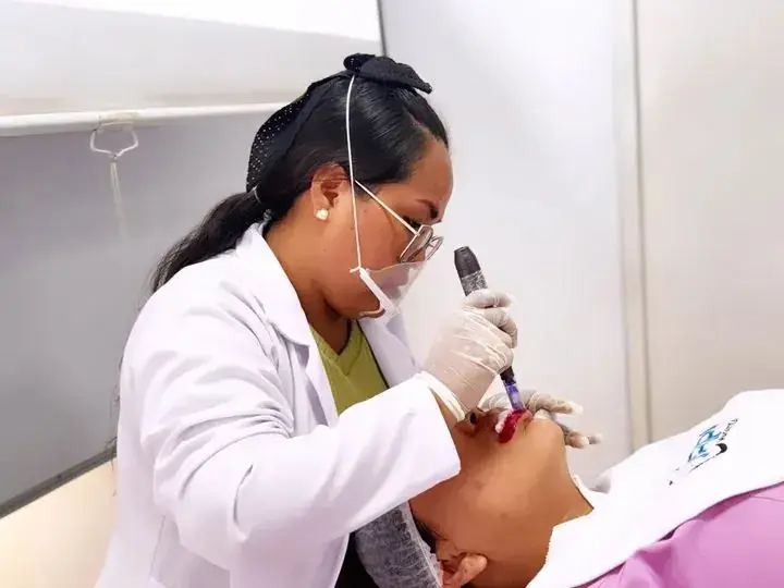 Práctica de microneedling en cabina